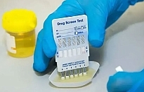 İş Dünyasında Yeni Dönem: İşe Girişlerde Uyuşturucu Testi Zorunluluğu Yayılıyor!