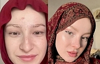 Fatma Soydaş’ın Eski Hali Sosyal Medyayı Salladı