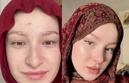 Fatma Soydaş’ın Eski Hali Sosyal Medyayı Salladı