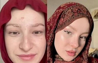 Fatma Soydaş’ın Eski Hali Sosyal Medyayı Salladı