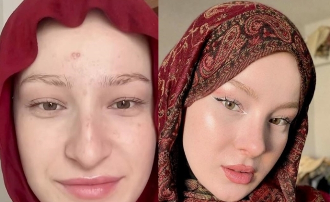 Fatma Soydaş’ın Eski Hali Sosyal Medyayı Salladı