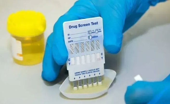 İş Dünyasında Yeni Dönem: İşe Girişlerde Uyuşturucu Testi Zorunluluğu Yayılıyor!